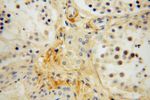 Collagen Type VI Antibody in Immunohistochemistry (Paraffin) (IHC (P))