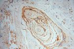 Collagen Type VI Antibody in Immunohistochemistry (Paraffin) (IHC (P))