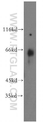 GEFT Antibody in Western Blot (WB)