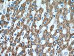 MUT Antibody in Immunohistochemistry (Paraffin) (IHC (P))