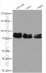 MUT Antibody in Western Blot (WB)