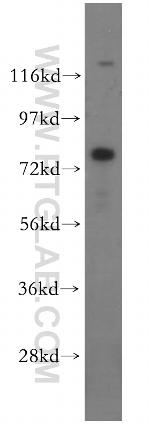 MUT Antibody in Western Blot (WB)