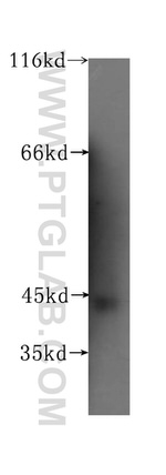 GALT Antibody in Western Blot (WB)