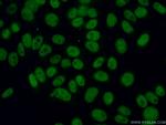 CHAF1A Antibody in Immunocytochemistry (ICC/IF)