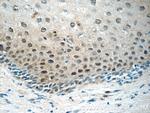 CHAF1A Antibody in Immunohistochemistry (Paraffin) (IHC (P))