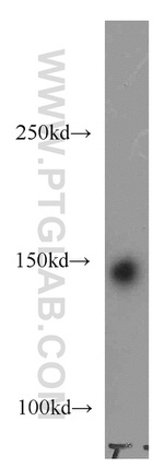 CHAF1A Antibody in Western Blot (WB)