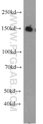 CHAF1A Antibody in Western Blot (WB)