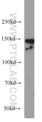 CHAF1A Antibody in Western Blot (WB)