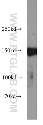CHAF1A Antibody in Western Blot (WB)