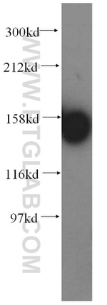 CHAF1A Antibody in Western Blot (WB)