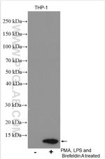 CXCL8/IL-8 Antibody in Western Blot (WB)