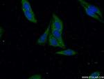 METAP2 Antibody in Immunocytochemistry (ICC/IF)