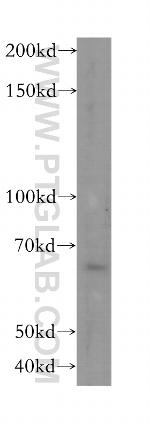 METAP2 Antibody in Western Blot (WB)