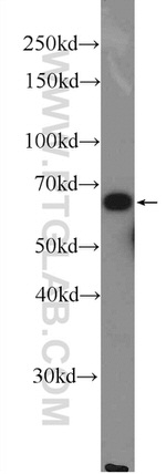 METAP2 Antibody in Western Blot (WB)