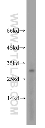 ROGDI Antibody in Western Blot (WB)