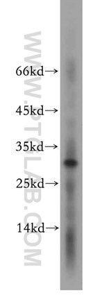 ROGDI Antibody in Western Blot (WB)