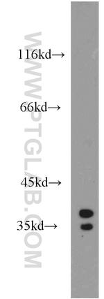 STARD10 Antibody in Western Blot (WB)