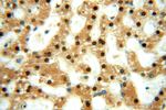 GTF2IRD1 Antibody in Immunohistochemistry (Paraffin) (IHC (P))