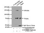 GTF2IRD1 Antibody in Immunoprecipitation (IP)