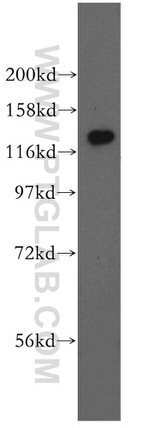 GTF2IRD1 Antibody in Western Blot (WB)