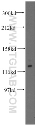 GTF2IRD1 Antibody in Western Blot (WB)