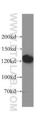 GTF2IRD1 Antibody in Western Blot (WB)