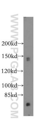 GTF2IRD1 Antibody in Western Blot (WB)