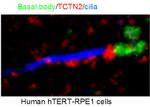 TCTN2 Antibody in Immunocytochemistry (ICC/IF)