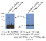 TCTN2 Antibody in Immunoprecipitation (IP)