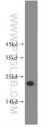 UBE2F Antibody in Western Blot (WB)