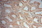 LARP7 Antibody in Immunohistochemistry (Paraffin) (IHC (P))