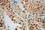 LARP7 Antibody in Immunohistochemistry (Paraffin) (IHC (P))