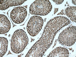 TEX12 Antibody in Immunohistochemistry (Paraffin) (IHC (P))