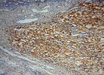 TEX12 Antibody in Immunohistochemistry (Paraffin) (IHC (P))