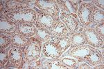 TEX12 Antibody in Immunohistochemistry (Paraffin) (IHC (P))