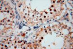 TEX12 Antibody in Immunohistochemistry (Paraffin) (IHC (P))