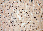 TEX12 Antibody in Immunohistochemistry (Paraffin) (IHC (P))