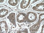 TEX12 Antibody in Immunohistochemistry (Paraffin) (IHC (P))