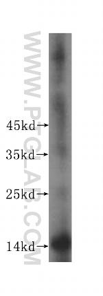 TEX12 Antibody in Western Blot (WB)