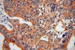 EIF5A2 Antibody in Immunohistochemistry (Paraffin) (IHC (P))