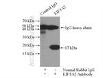 EIF5A2 Antibody in Immunoprecipitation (IP)