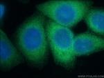 LZTFL1 Antibody in Immunocytochemistry (ICC/IF)