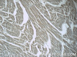 LZTFL1 Antibody in Immunohistochemistry (Paraffin) (IHC (P))