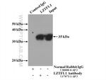 LZTFL1 Antibody in Immunoprecipitation (IP)