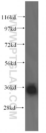 LZTFL1 Antibody in Western Blot (WB)