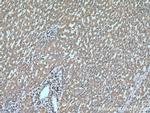 PIP4K2C Antibody in Immunohistochemistry (Paraffin) (IHC (P))