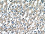 PIP4K2C Antibody in Immunohistochemistry (Paraffin) (IHC (P))