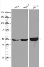 PIP4K2C Antibody in Western Blot (WB)