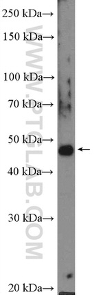 PIP4K2C Antibody in Western Blot (WB)