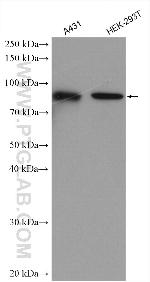 TBC1D5 Antibody in Western Blot (WB)